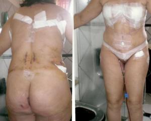 CURY ACORDOU AS MULHERES DO SONHO DE SER BELAS